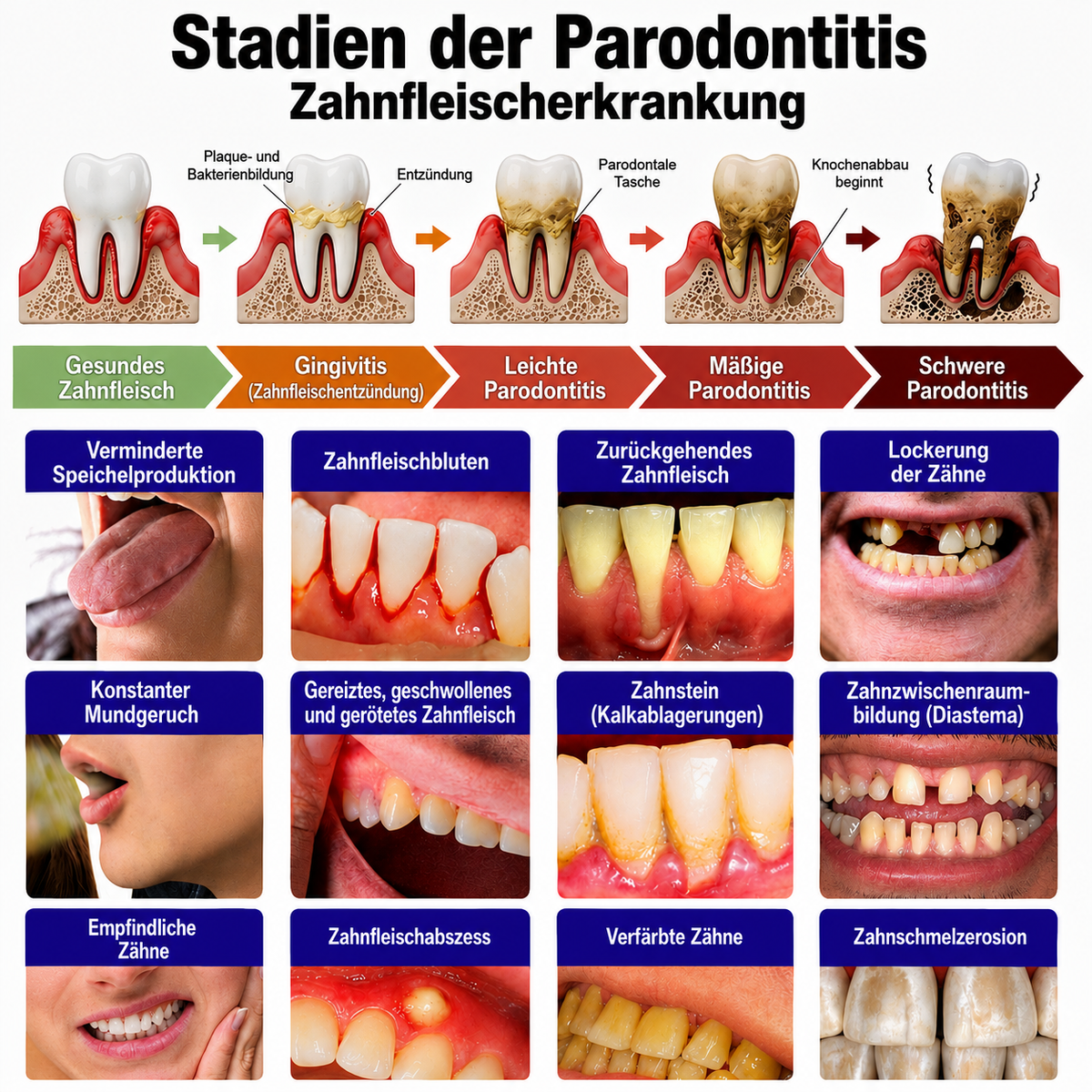 𝐍𝐚𝐭𝐫𝐚𝐯𝐨𝐫® VioCore Zahnpasta zur Behandlung von Zahnfleischentzündungen und Parodontitis mit Bienengift