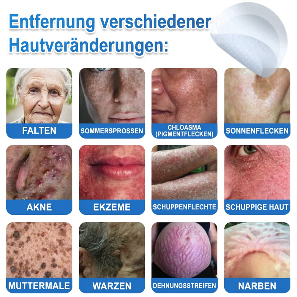 🏆𝑻𝒐𝒑𝑺𝒑𝒊𝒓𝒆® 2-in-1 Mikronadel- & Hydrokolloid-Pflaster | Entferner für erhabene Muttermale, Akne, flache Warzen & Hautanhängsel | Verbessert Falten, Narben & Hautunreinheiten | Unsichtbare Stern-Pickelpflaster für Gesicht & Körper