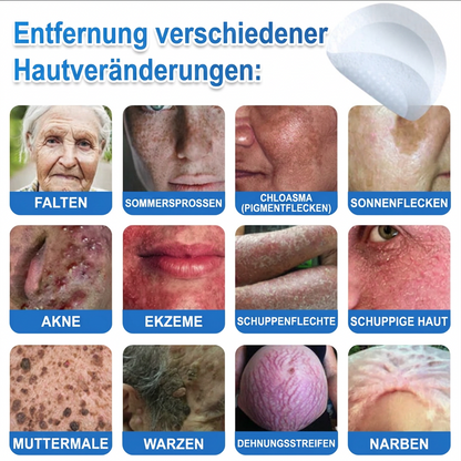 🏆𝑻𝒐𝒑𝑺𝒑𝒊𝒓𝒆® 2-in-1 Mikronadel- & Hydrokolloid-Pflaster | Entferner für erhabene Muttermale, Akne, flache Warzen & Hautanhängsel | Verbessert Falten, Narben & Hautunreinheiten | Unsichtbare Stern-Pickelpflaster für Gesicht & Körper