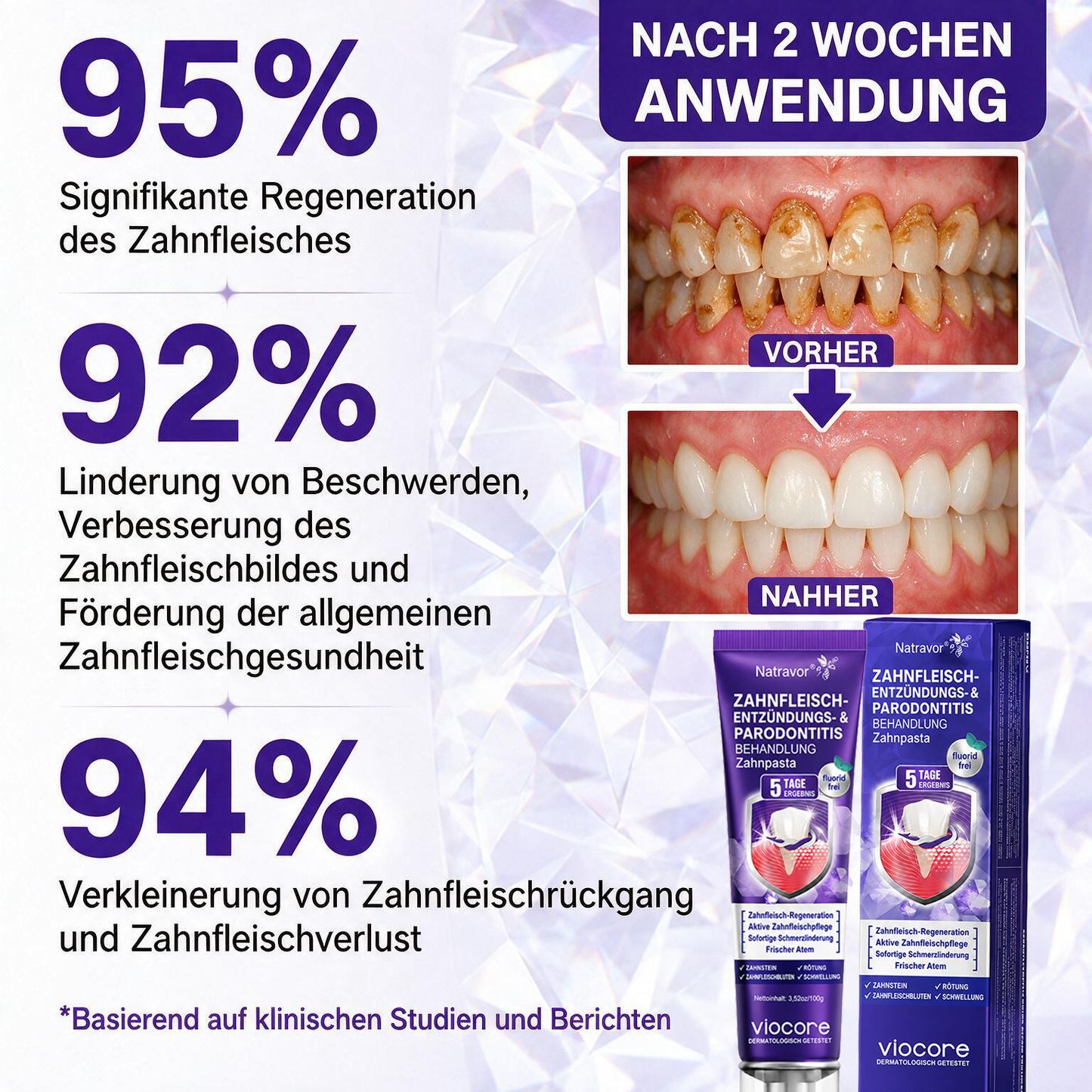 𝐍𝐚𝐭𝐫𝐚𝐯𝐨𝐫® VioCore Zahnpasta zur Behandlung von Zahnfleischentzündungen und Parodontitis mit Bienengift