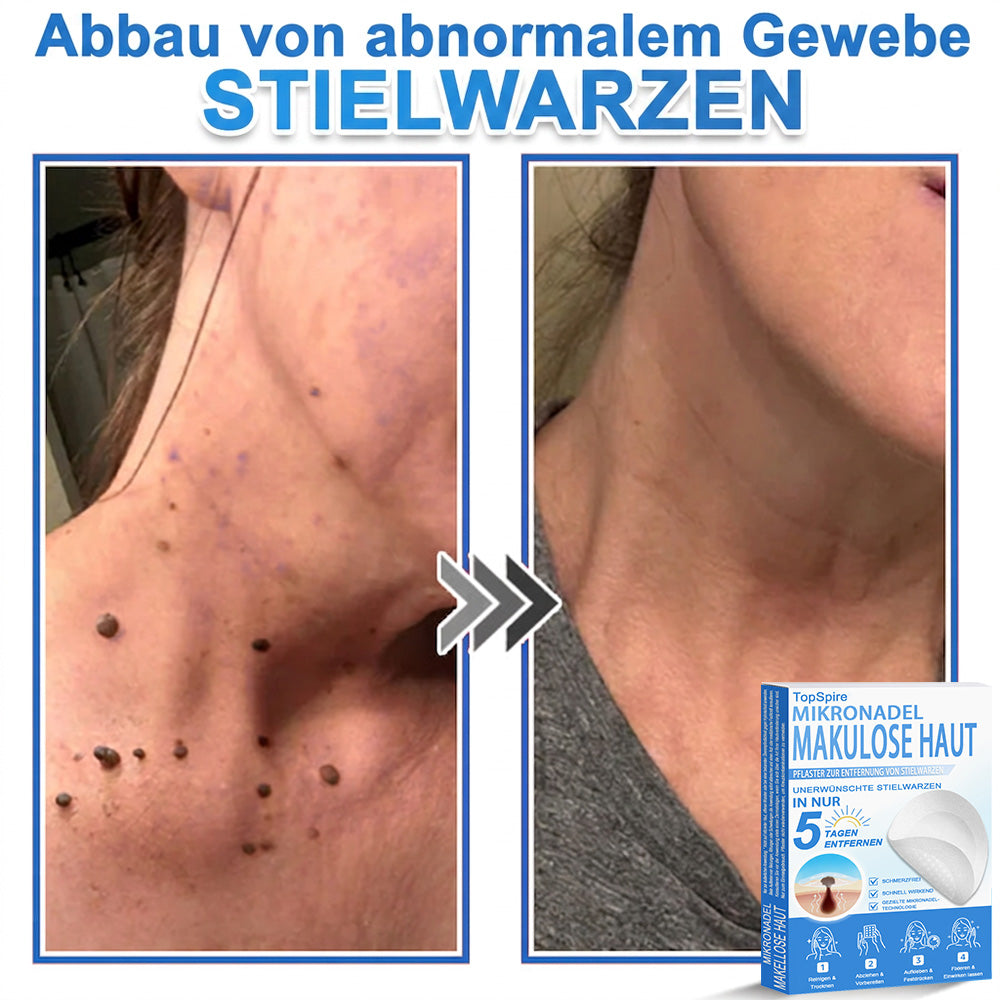 🏆𝑻𝒐𝒑𝑺𝒑𝒊𝒓𝒆® 2-in-1 Mikronadel- & Hydrokolloid-Pflaster | Entferner für erhabene Muttermale, Akne, flache Warzen & Hautanhängsel | Verbessert Falten, Narben & Hautunreinheiten | Unsichtbare Stern-Pickelpflaster für Gesicht & Körper