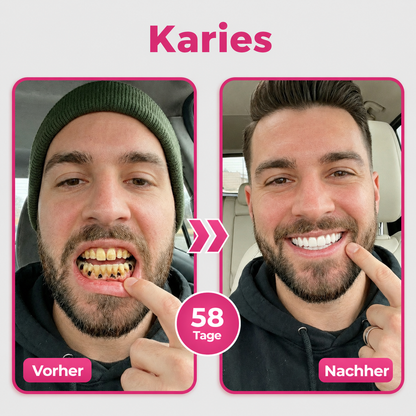 🦷Natravor® Thismile NH-10 Zahnpasta-Serum für Zahnschmelz und Zahnfleisch – Advanced Therapy