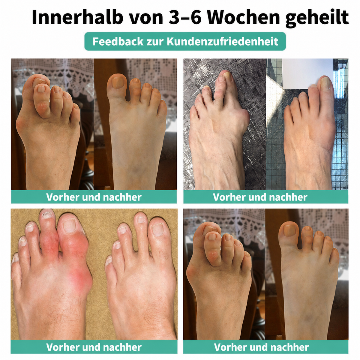 🏅 Natravor® Botanisches Komfort-Pflaster bei Hallux valgus 👠 Flexible Fußpflege + pflanzlich inspirierte Komfortformel a