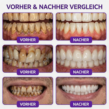 𝐍𝐚𝐭𝐫𝐚𝐯𝐨𝐫® VioCore Zahnpasta zur Behandlung von Zahnfleischentzündungen und Parodontitis mit Bienengift